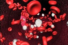 Гипокалиемия - пониженное содержание в крови человека калия
